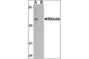 Western blot analysis of Rkhd4 in SK-N-SH cell lysate with this product at 1 μg/ml in (A) the absence and (B) the presence of blocking peptide. (MEX3A 抗体  (C-Term))