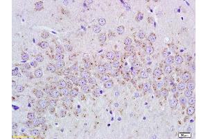 Formalin-fixed and paraffin embedded rat brain tissue labeled with Anti-cGMP Polyclonal Antibody, Unconjugated (ABIN750733) at 1:400, followed by conjugation to the secondary antibody and DAB staining (Cyclic GMP 抗体)