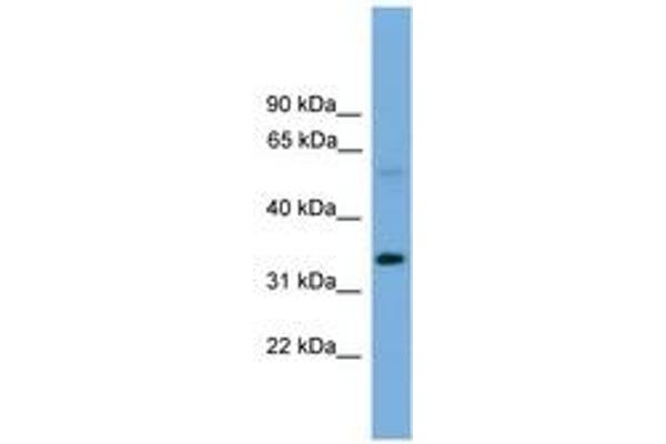 Transmembrane 7 Superfamily Member 4 (TM7SF4) (AA 101-150) 抗体