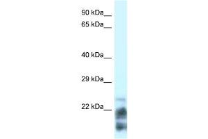 WB Suggested Anti-MDP-1 Antibody Titration: 0. (MDP1 抗体  (N-Term))