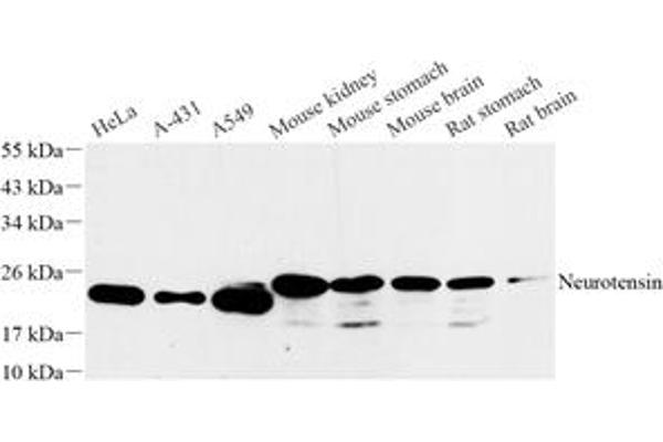 Neurotensin 抗体