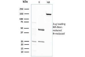 SDS-PAGE (SDS) image for anti-Glutathione S-Transferase mu 4 (GSTM4) antibody (ABIN6939574)