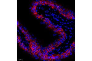 Immunofluorescence of paraffin embedded rat bladder using CK13 (ABIN7074412) at dilution of 1:1500 (400x lens) (Cytokeratin 13 抗体  (N-Term))
