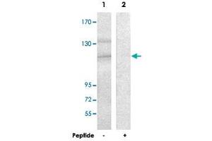 Western blot analysis of extracts from HUVEC cells, using SDCCAG1 polyclonal antibody .