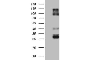 Western Blotting (WB) image for anti-Immunoglobulin Superfamily, Member 11 (IGSF11) (AA 23-241) antibody (ABIN2674600) (IGSF11 抗体  (AA 23-241))