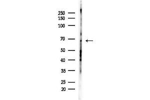 Western blot analysis of lysates from Hela cells(heat-shock,45 min treatment), using GRK5 Antibody at 1/1000 dilution.
