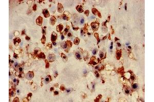 Immunohistochemistry of paraffin-embedded human placenta tissue using ABIN7153453 at dilution of 1:100 (Galectin 3 抗体  (AA 2-250))
