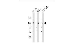 All lanes : Anti-DEPD5 Antibody (C-term) at 1:2000 dilution Lane 1: HL-60 whole cell lysate Lane 2: KG-1 whole cell lysate Lane 3: U-87 MG whole cell lysate Lysates/proteins at 20 μg per lane. (DEPDC5 抗体  (AA 1404-1432))