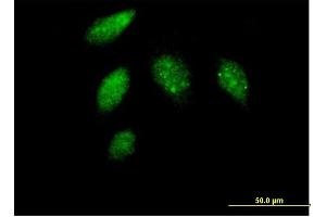 Immunofluorescence of purified MaxPab antibody to CCNG1 on HeLa cell. (Cyclin G1 抗体  (AA 1-295))