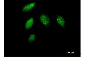 Immunofluorescence of purified MaxPab antibody to CCNG1 on HeLa cell. (Cyclin G1 抗体  (AA 1-295))
