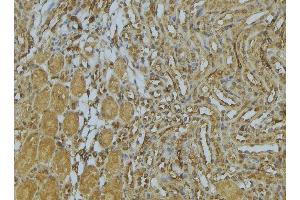 ABIN6273032 at 1/100 staining Mouse kidney tissue by IHC-P. (AP1M1 抗体  (Internal Region))