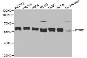 Western blot analysis of extracts of various cell lines, using PTBP1 antibody. (PTBP1 抗体  (AA 1-100))