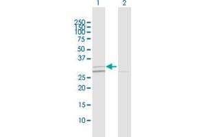 Western Blot analysis of SIRT5 expression in transfected 293T cell line by SIRT5 MaxPab polyclonal antibody. (SIRT5 抗体  (AA 1-310))