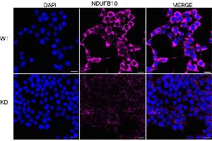anti-NADH Dehydrogenase (Ubiquinone) 1 beta Subcomplex, 10, 22kDa (NDUFB10) antibody