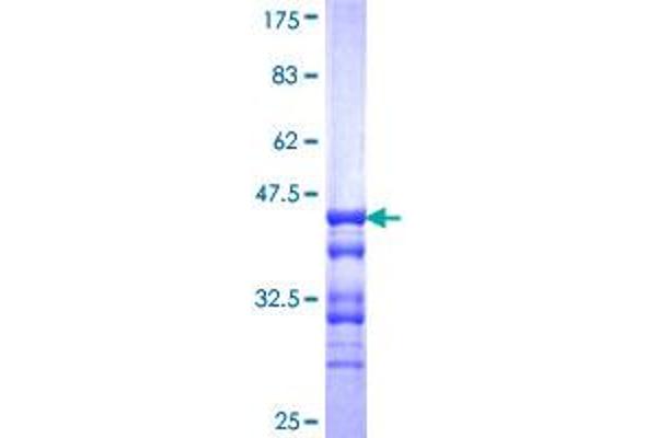 NXNL1 Protein (AA 81-190) (GST tag)