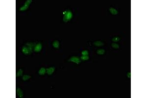 Immunofluorescent analysis of HepG2 cells using ABIN7167020 at dilution of 1:100 and Alexa Fluor 488-congugated AffiniPure Goat Anti-Rabbit IgG(H+L) (RACGAP1 抗体  (AA 86-331))