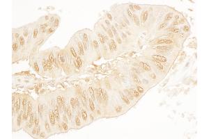 Immunohistochemistry (IHC) image for anti-Stromal Antigen 2 (STAG2) (AA 1125-1175) antibody (ABIN7454843)