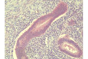 Anti-TSN / Translin antibody IHC staining of human uterus, endometrium. (Translin 抗体  (C-Term))
