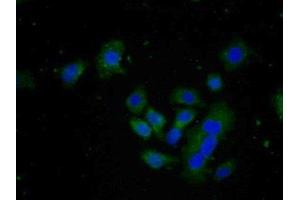 Detection of FAPa in Human HepG2 cell using Polyclonal Antibody to Fibroblast Activation Protein Alpha (FAPa) (FAP 抗体  (AA 542-761))