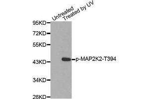 Western blot analysis of extracts from HepG2 cells using Phospho-MAP2K2-T394 antibody. (MEK2 抗体  (pThr394))