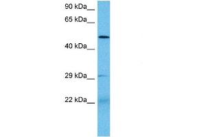 Host:  Mouse  Target Name:  PAX3  Sample Tissue:  Mouse Small Intestine  Antibody Dilution:  1ug/ml (Paired Box 3 抗体  (N-Term))