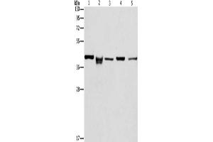 Gel: 10 % SDS-PAGE, Lysate: 40 μg, Lane 1-5: HepG2 cells, mouse kidney tissue, lovo cells, mouse eyes tissue, hela cells, Primary antibody: ABIN7129804(IDH3B Antibody) at dilution 1/233. (IDH3B 抗体)
