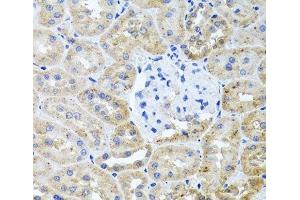 Immunohistochemistry of paraffin-embedded Rat kidney using HDAC6 Polyclonal Antibody at dilution of 1:100 (40x lens). (HDAC6 抗体)
