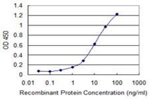 Detection limit for recombinant GST tagged SCML2 is 0. (SCML2 抗体  (AA 251-350))