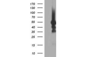 Image no. 1 for anti-Tubulin, beta 1 (TUBB1) antibody (ABIN1501569) (TUBB1 抗体)