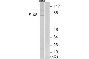 Western blot analysis of extracts from K562 cells, using SIX5 antibody. (Six5 抗体  (Internal Region))