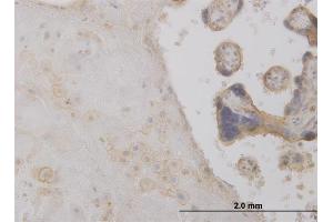 Immunoperoxidase of monoclonal antibody to DCTD on formalin-fixed paraffin-embedded human placenta. (DCMP Deaminase (DCTD) (AA 69-178) 抗体)