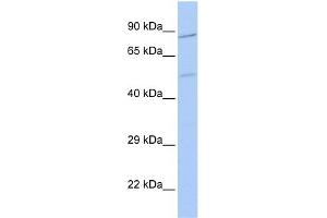 WB Suggested Anti-ZNF585B Antibody Titration:  0. (ZNF585B 抗体  (N-Term))