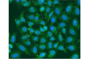 Immunofluorescence staining of U2OS cells with ABIN7141844 at 1:100, counter-stained with DAPI. (XBP1 抗体  (AA 1-261))