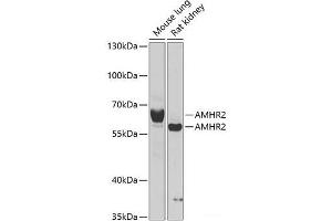 Western blot analysis of extracts of various cell lines using AMHR2 Polyclonal Antibody at dilution of 1:1000.