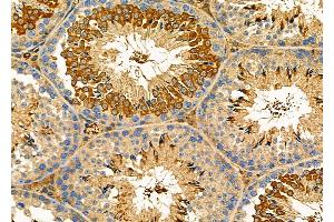 ABIN6260030 and ABIN6276614 at 1/100 staining Mouse testis tissue by IHC-P.