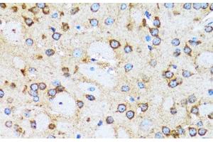 Immunohistochemistry of paraffin-embedded Rat brain using ACTR2 Polyclonal Antibody at dilution of 1:100 (40x lens). (ACTR2 抗体)
