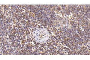 Detection of IL6 in Human Spleen Tissue using Monoclonal Antibody to Interleukin 6 (IL6) (IL-6 抗体  (AA 30-212))
