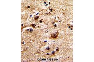 Formalin-fixed and paraffin-embedded human brain with ADRA1B Antibody (Center), which was peroxidase-conjugated to the secondary antibody, followed by DAB staining.