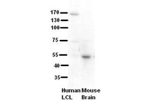 WB Suggested Anti-RRP1 Antibody Titration:  5% Milk  ELISA Titer:  dilution: 1:500  Positive Control:  human LCL and mouse brains (RRP1 抗体  (C-Term))