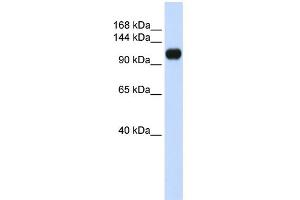 WB Suggested Anti-KIAA0692 Antibody Titration: 0. (ANKLE2 抗体  (Middle Region))
