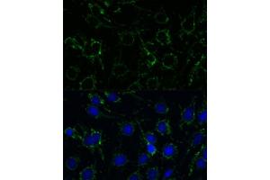Immunofluorescence analysis of C6 cells using GLUD1 antibody (ABIN6127975, ABIN6141157, ABIN6141158 and ABIN6223546) at dilution of 1:100. (GLUD1 抗体  (AA 54-240))