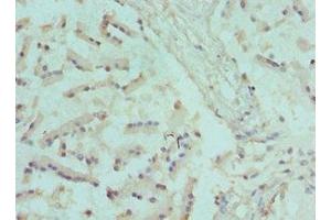 Immunohistochemistry of paraffin-embedded human prostate tissue using ABIN7170062 at dilution of 1:100 (CANT1 抗体  (AA 102-401))