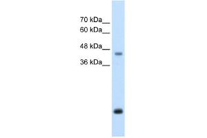 WB Suggested Anti-ASPN Antibody Titration:  2. (Asporin 抗体  (Middle Region))