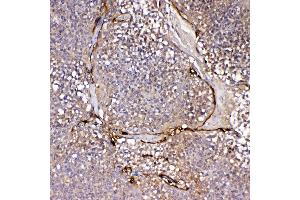 IHC analysis of IL1F10 using anti-IL1F10 antibody . (IL1F10 抗体  (AA 1-152))