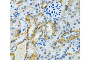 Immunohistochemistry of paraffin-embedded Rat kidney using GDAP1 Polyclonal Antibody at dilution of 1:100 (40x lens). (GDAP1 抗体)