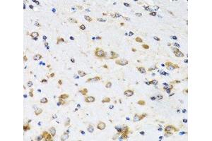 Immunohistochemistry of paraffin-embedded Mouse brain using COPB2 Polyclonal Antibody at dilution of 1:100 (40x lens). (COPB2 抗体)