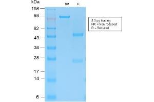 SDS-PAGE Analysis Purified Cytokeratin 15 Rabbit Recombinant Monoclonal Ab (KRT15/2103R).