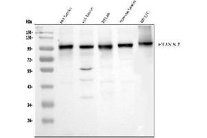 Western blot analysis of FOXK1 using anti-FOXK1 antibody (ABIN7600295).