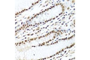 Immunohistochemistry (Paraffin-embedded Sections) (IHC (p)) image for anti-Methyltransferase Like 3 (METTL3) (AA 1-156) antibody (ABIN6143771)