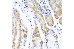Immunohistochemistry of paraffin-embedded human stomach using CST1 antibody at dilution of 1:100 (40x lens). (CST1 抗体)